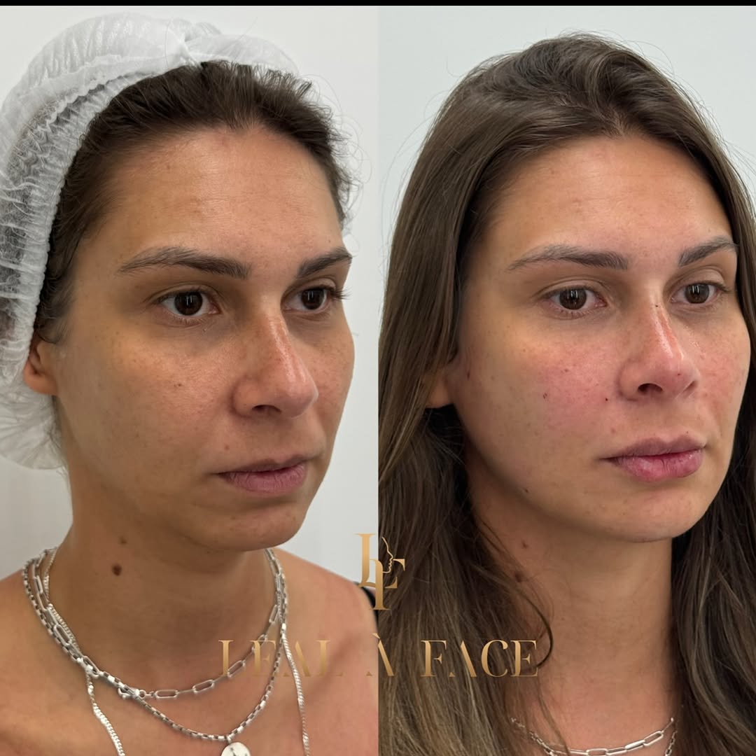 2 reais ou uma harmonização misteriosa 🙈