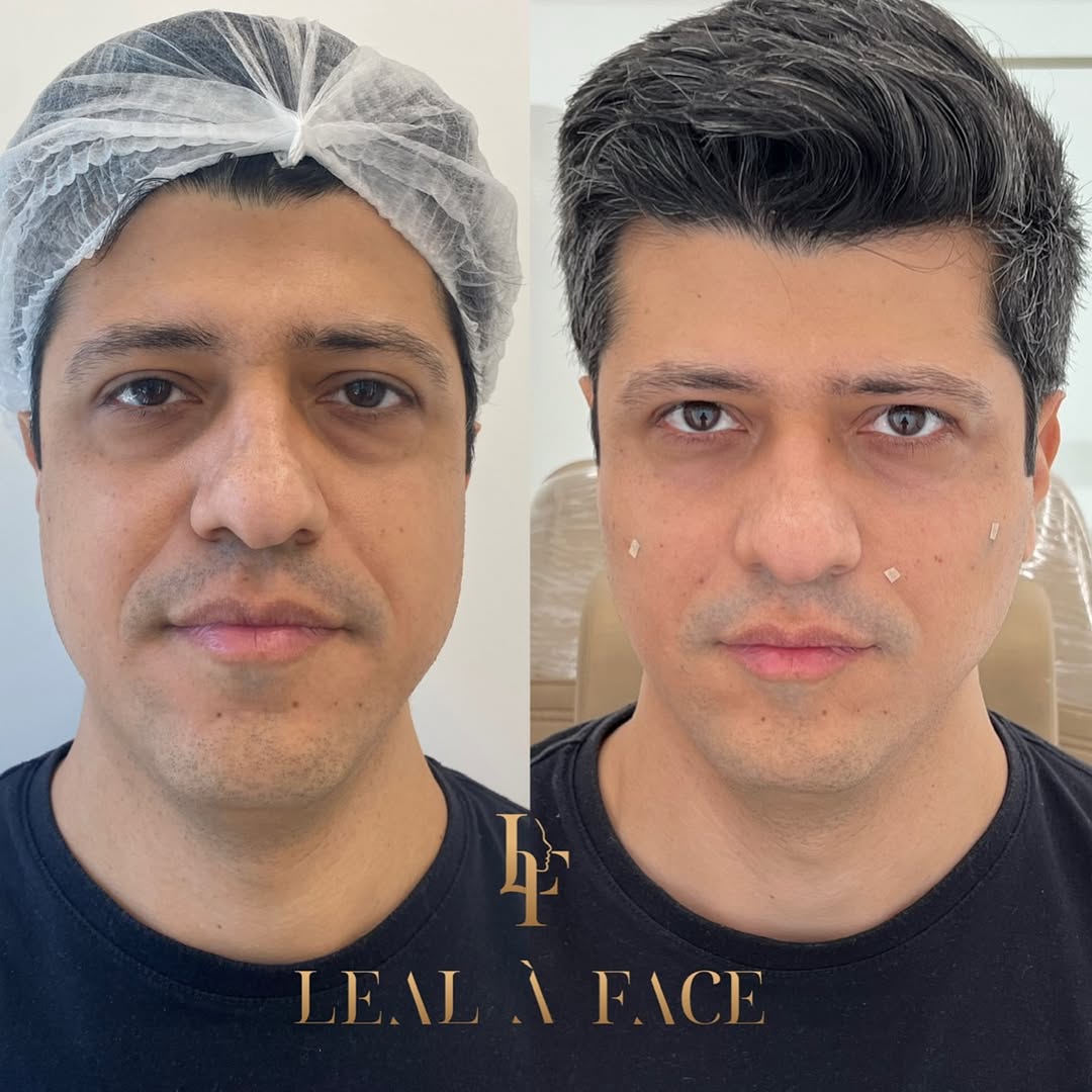 Homens também buscam sua melhor versão 💆🏽_♂️
